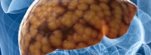 Venerdì 28 luglio 2023, Giornata mondiale dell’Epatite. Messaggio scelto: ” Una vita, un fegato”
